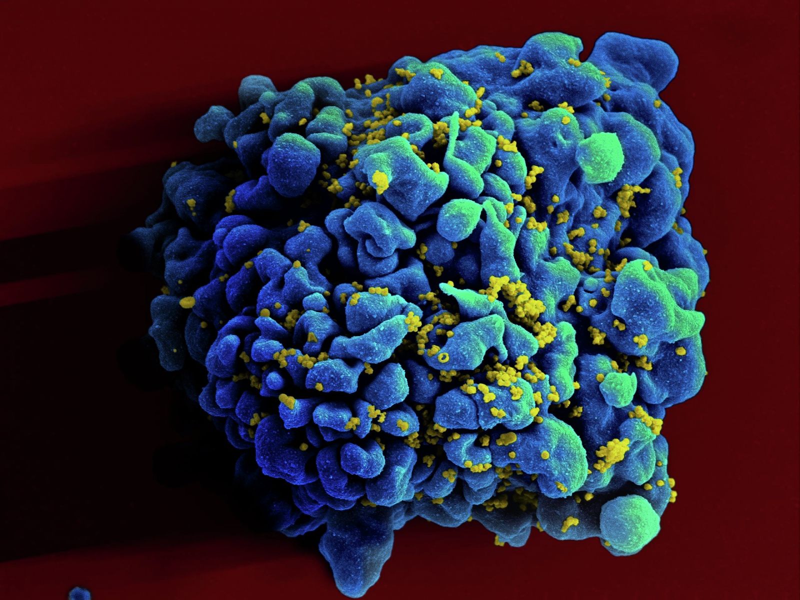 HIV-infected H9 T cell